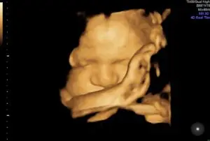 3D Ultrasound Gallery: See Your Baby in Stunning HD | BabyLove Ultrasound