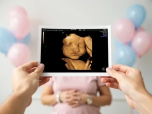 Get Your 3D Gender Ultrasound Appointment Today in League City for Expectant Parents